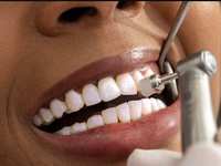 How Often Should You Get a Dental Cleaning in The Woodlands?